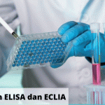 Perbedaan ELISA dan ECLIA Dalam Tes Serologi