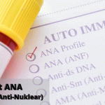 Mengenal Tes ANA Dalam Pemeriksaan Autoimun